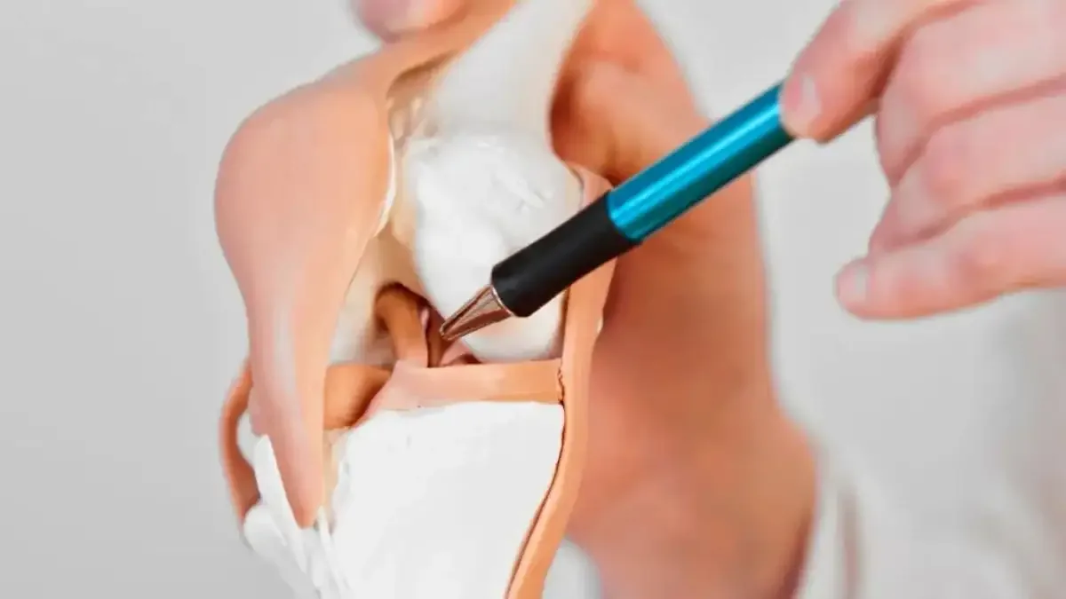 Ruptura completa do ligamento cruzado anterior precisa operar