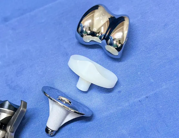 Prótese de Joelho em Goiânia - Artroplastia Total