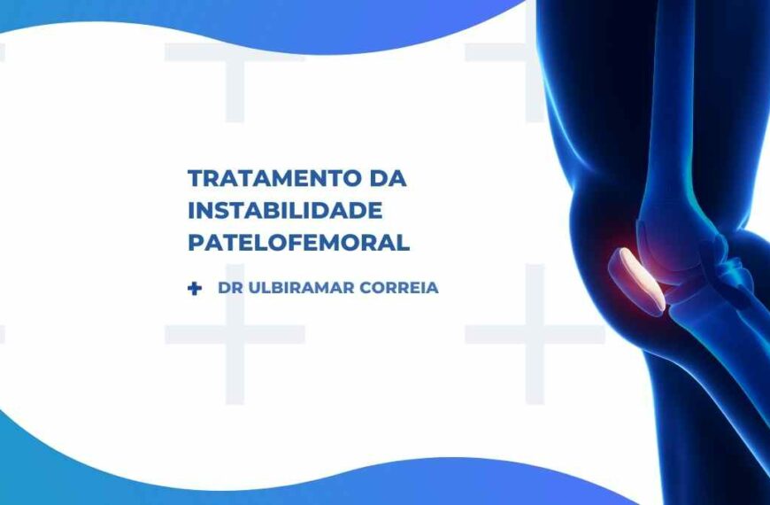 Tratamento da Instabilidade Patelofemoral em Goiânia: Onde tratar?