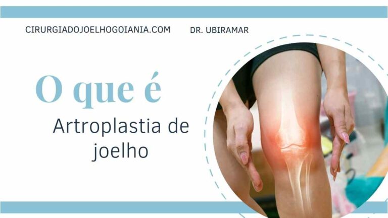 Artroplastia de joelho em Goiânia, o que é
