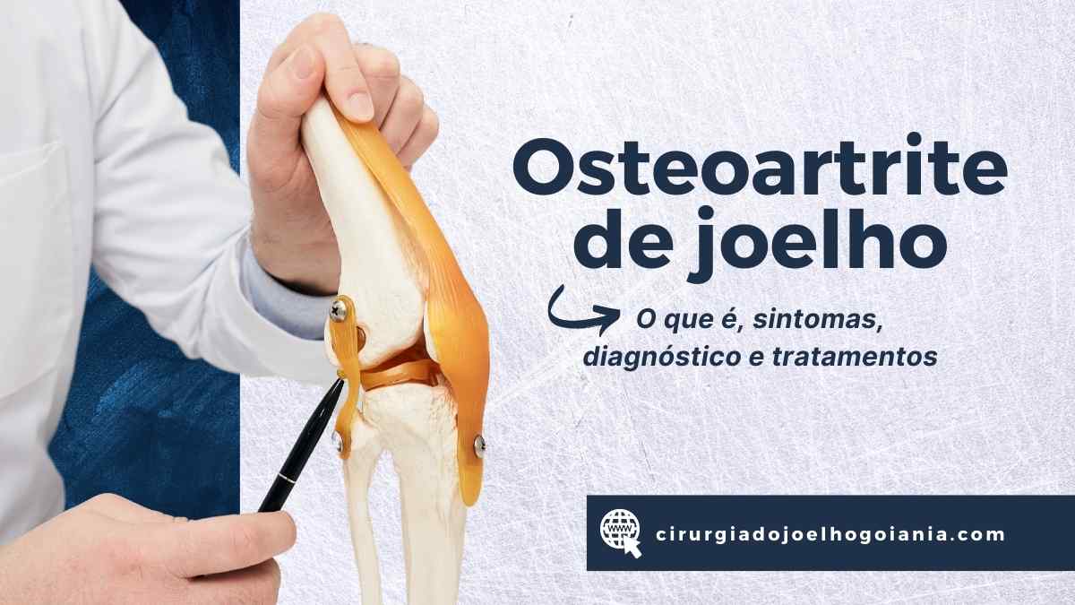 Osteoartrite de joelho – o que é, sintomas, diagnóstico e tratamentos