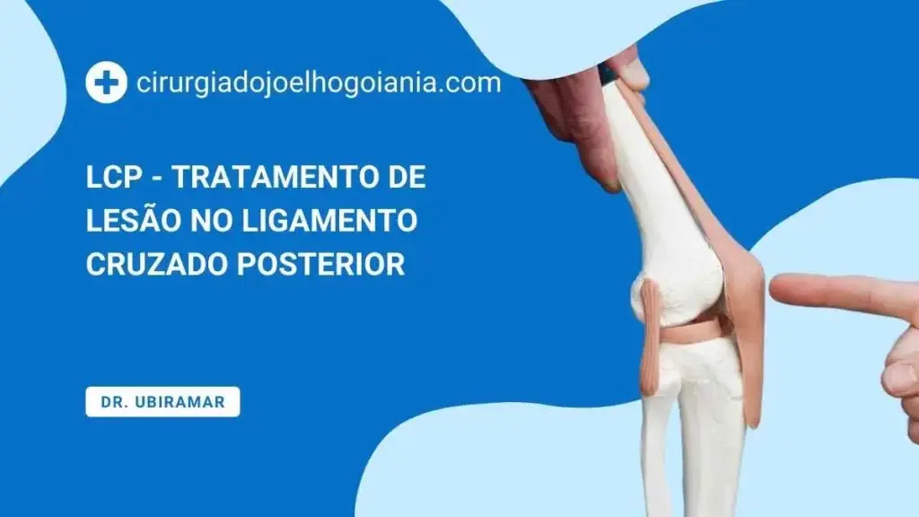 LCP - Tratamento de lesão no ligamento cruzado posterior